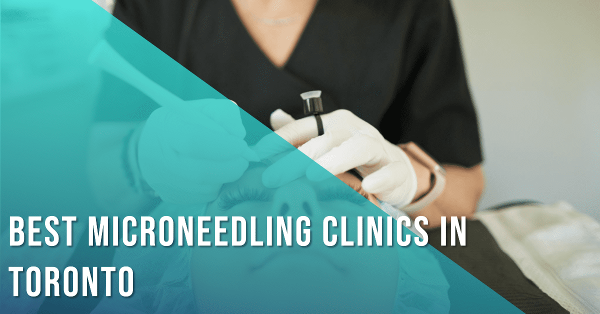 Best Clinics For Microneedling In Toronto
