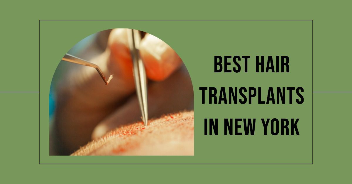 best hair transplants in new york