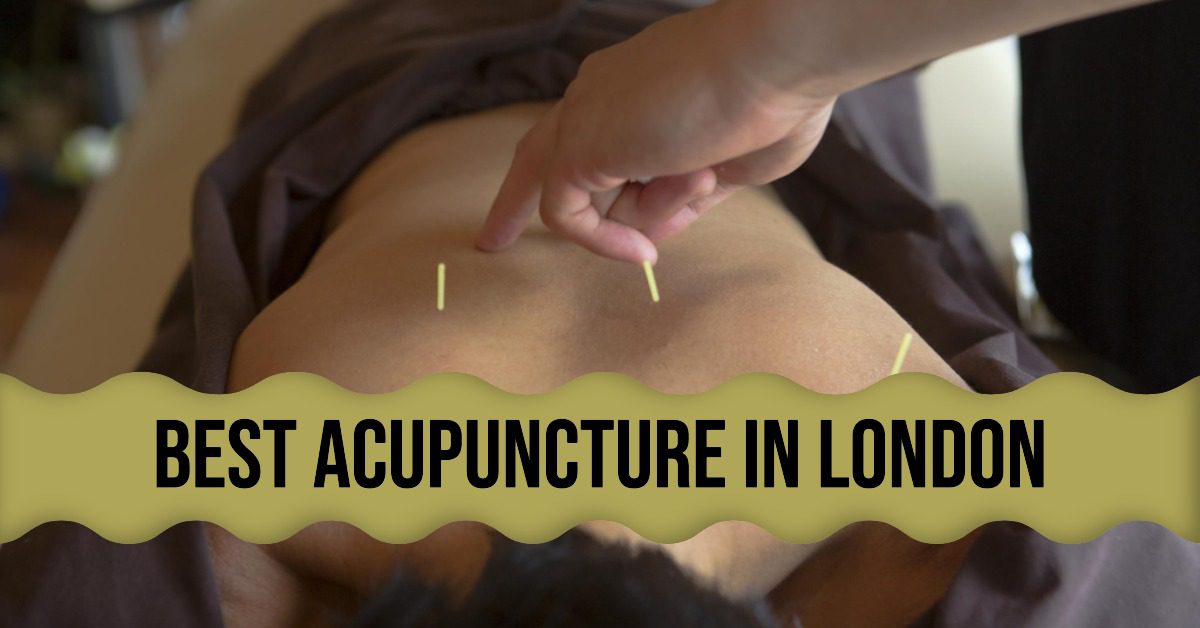 Best Acupuncture In London