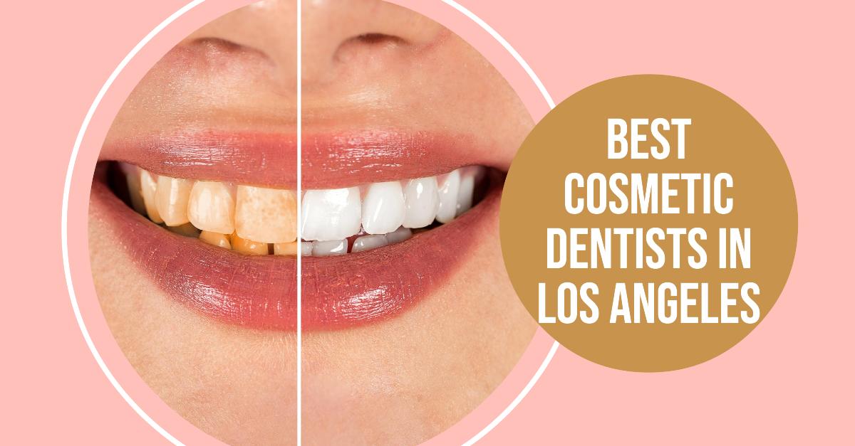 5 Best Cosmetic Dentists In Los Angeles (2024)