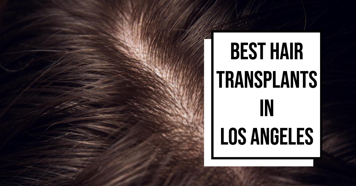 Best Hair Transplants In Los Angeles