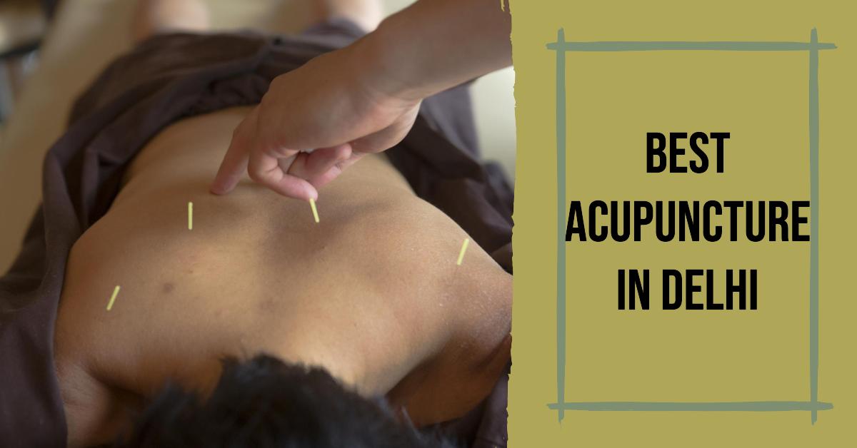 Best Acupuncture In Delhi